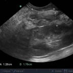 significant diffuse pancreatic disease (pancreatitis) in a dog